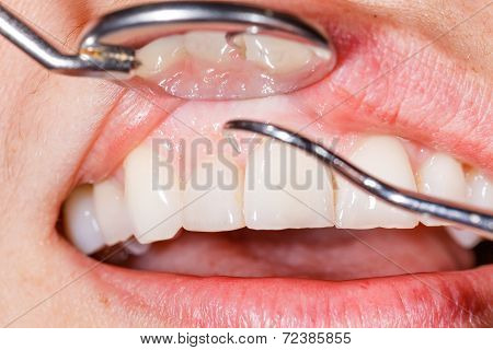 Dental Examination