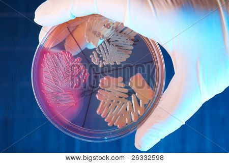 Mano in guanto piastra di Petri con batteri Escherichia Coli, Klebisiella Pneumoniae, Serratia M