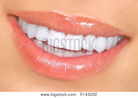 Dents femme