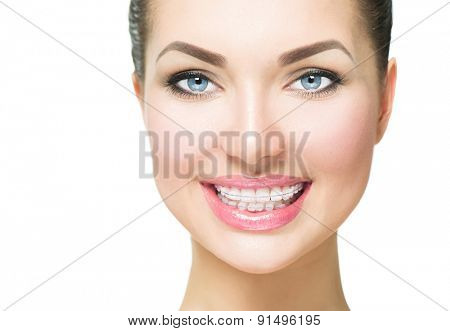 Braces. Beautiful Woman smile close up. Healthy Smile. Closeup Ceramic Braces on Teeth. Beautiful Female Smile with Braces. Orthodontic Treatment. Dental care Concept. Alignment of teeth