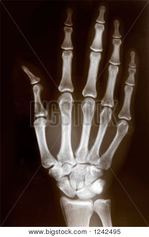 X-Ray von hand