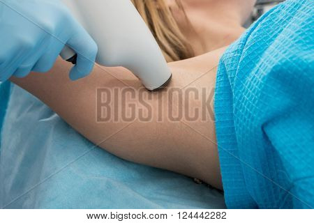 Procedure for armpit against hyperhidrosis