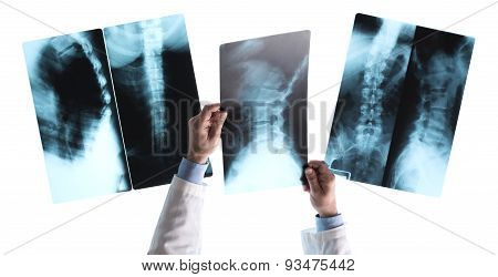 Radiologist Checking An X-ray Image