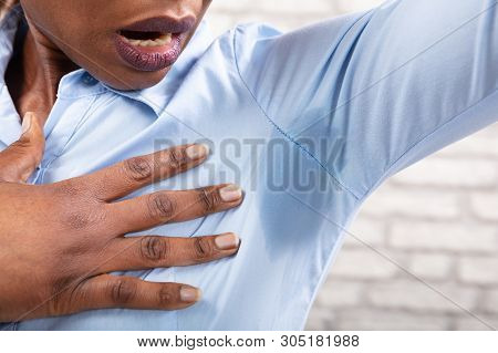 Close-up Of A Woman With Hyperhidrosis Sweating Very Badly Under Armpit