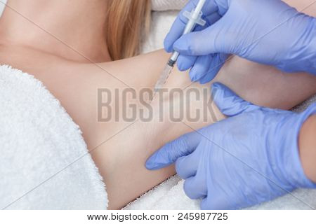 The Doctor Makes Intramuscular Injections Of Botulinum Toxin In The Underarm Area Against Hyperhidro