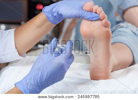 The Doctor Makes Intramuscular Injections Of Botulinum Toxinon The Feet Of A Woman Against Hyperhidr