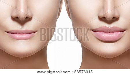 Before and after lip filler injections. Fillers. Lip augmentation Beautiful Perfect Lips. Sexy Mouth close up. Beauty young woman Lips. Close up over white background 