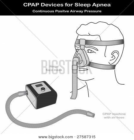 Sleep Apnea, Cpap Machine, Nose Mask