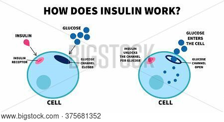 Flat Vector Illustration Of Importance Of Insulin. How Does Insulin Work, Educational Medical Visual