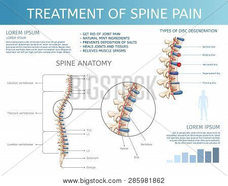 Vector Illustration Treatment Of Spine Pain. Spine Anatomy. Square Flat Banner On White Background. 