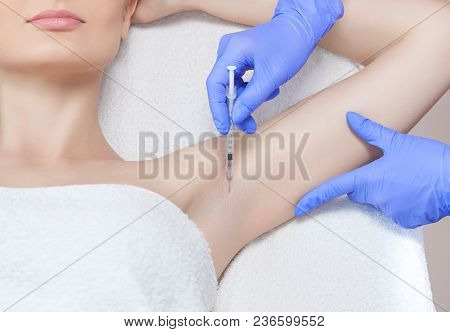 The Doctor Makes Intramuscular Injections Of Botulinum Toxin In The Underarm Area Against Hyperhidro