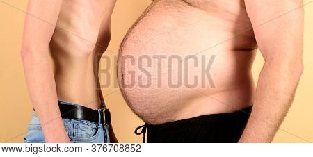 Obese Man Waist Body Fat. Man With Fat And Slim Figure On Yellow Background. Anorexia Vs Fat Problem