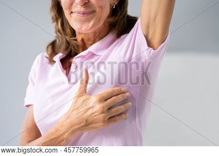 Woman With Hyperhidrosis Sweating Very Badly Under Armpit