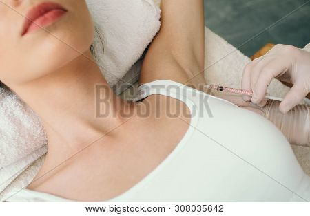 Woman Receives An Underarm Treatment, Hyperhidrosis. Armpit Injections To Prevent Excessive Sweating