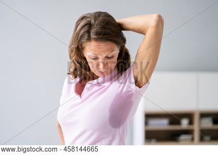 Woman With Hyperhidrosis Sweating Very Badly Under Armpit