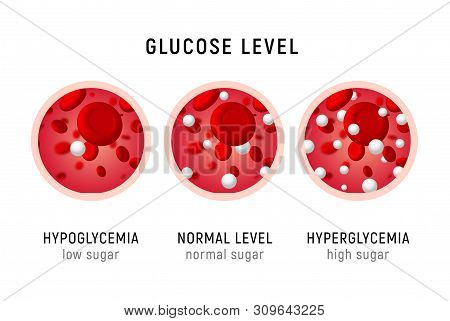 Glucose Blood Level Sugar Test. Diabetes Insulin Hypoglycemia Or Hyperglycemia Diagram Icon