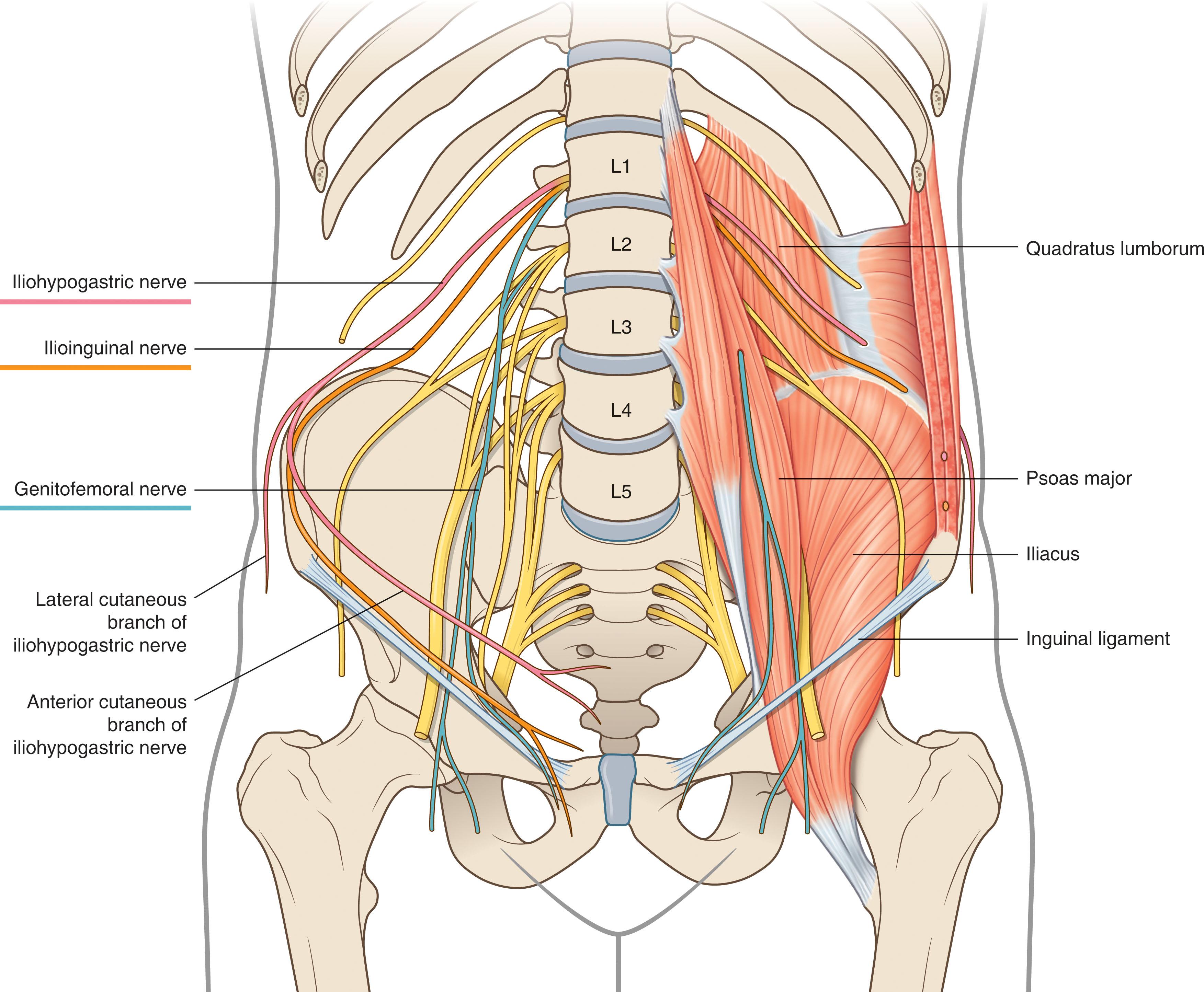 Figure 17.3, Left-sided psoas and quadratus lumborum muscles and the course of the iliohypogastric, ilioinguinal, and genitofemoral nerves.