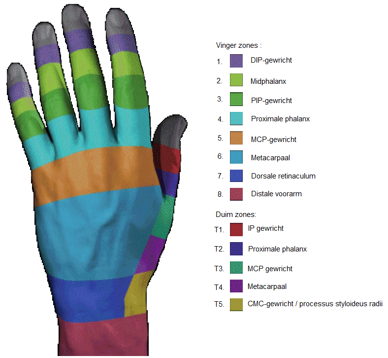 Extensor Zones