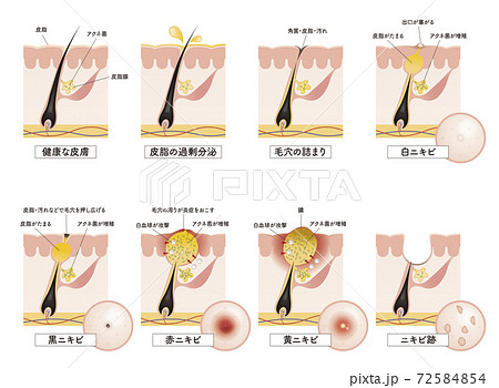 Cross section of the skin 15 front 72584854