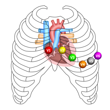 ECG Precordial Lead Position V1, V2, V3, V4, V5, And V6, 43% OFF