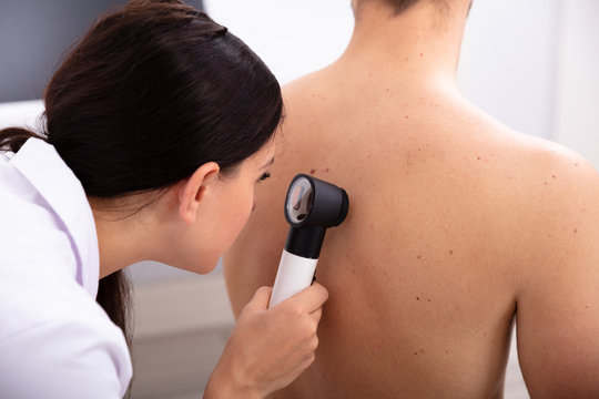 Doctor Examining Pigmented Skin On Man's Back