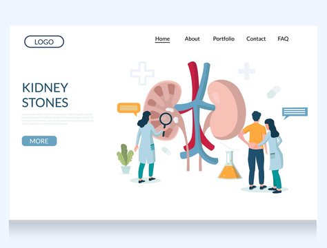 Kidney stones vector website landing page design template