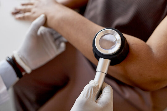 Close up of unrecognizable doctor holding dermatoscope while examining skin of patient at dermatology clinic copy space