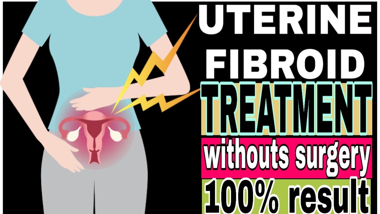 Uterine fibroids of TCM perspective