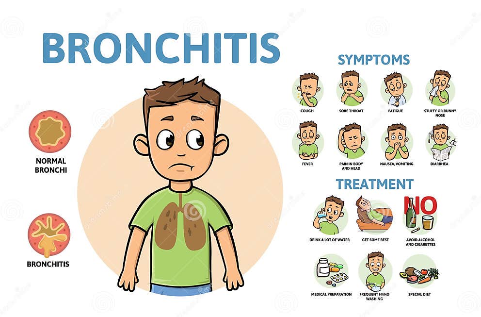 Bronchitis Disease Symptoms and Treatment. Infographic Poster with Text ...