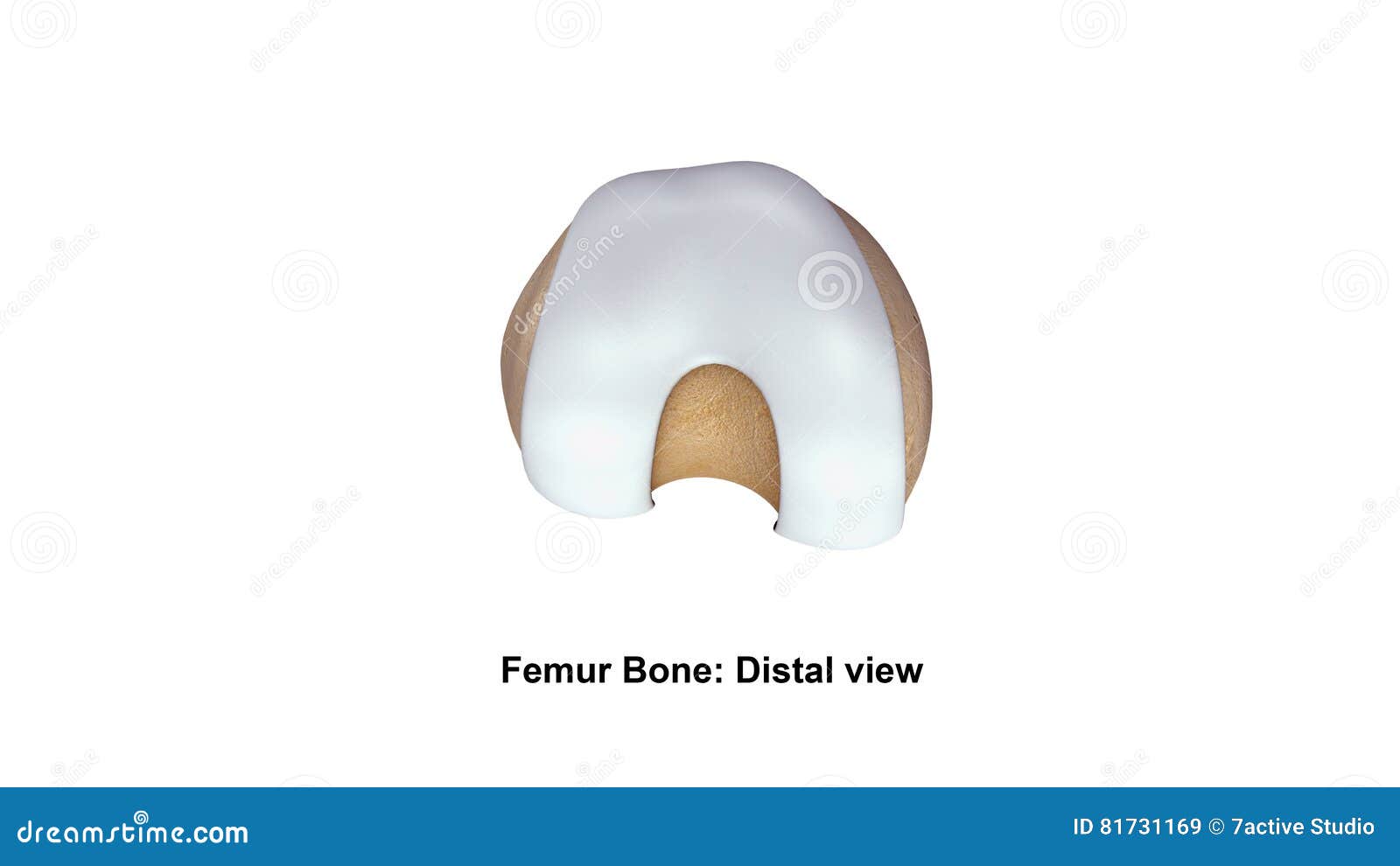 Distal Femur Bone