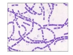 White Colour Bacillus Subtilis