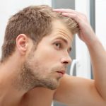 Top 10 Best Hair Loss Treatments for Men of 2024