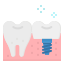 Dental Treatment