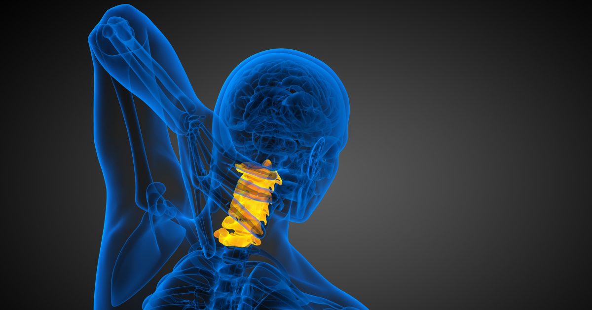 Occipital Neuralgia What Triggers