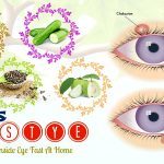 tips on how to treat a stye