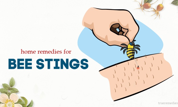 natural home remedies for bee stings