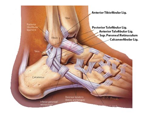 A Guide to Ankle Sprains | Hurst Podiatry