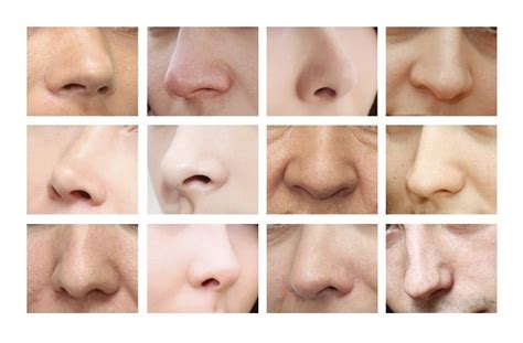 Types Of Nose Shape