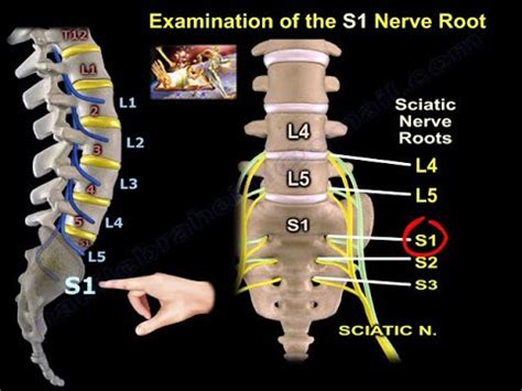 Examination Of S1 Nerve Root - Everything You Need To Know - Dr. Nabil ...