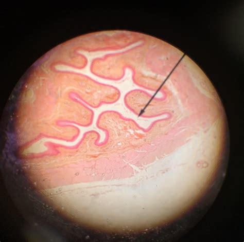 Esophagus histology Diagram | Quizlet