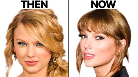 Taylor Swift NEW FACE | Plastic Surgery Analysis :: GentNews