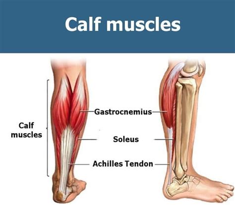 Calf strain - Sydney Physiotherapy