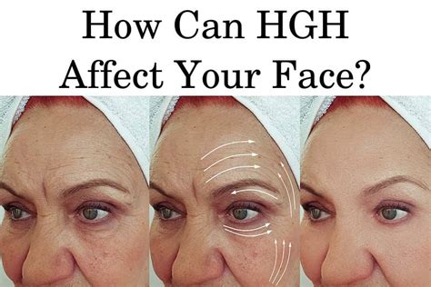 What Does HGH Do to Your Face and Head? | HFS Clinic [HGH & TRT]