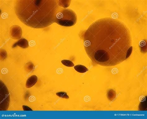 Candida Albicans Y Colonias Bacterianas Bajo El Microscopio Foto de ...