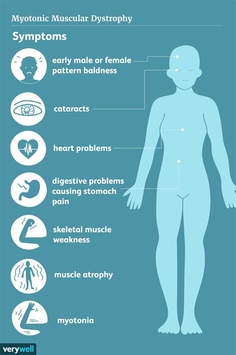 Myotonic Muscular Dystrophy: Symptoms, Causes, Diagnosis, Treatment ...