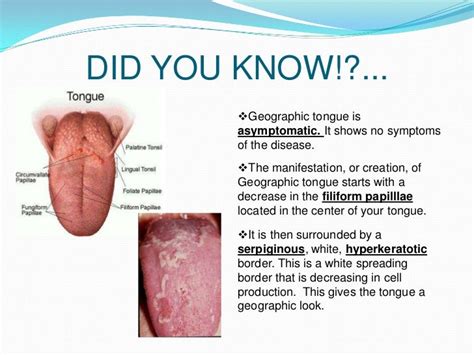 what cause thrush in adults - pictures, photos