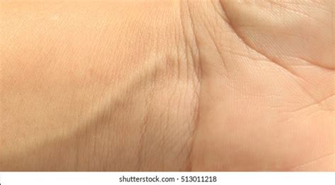 Human Hand Skin Texture Stock Photo 513011218 | Shutterstock