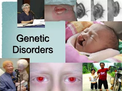 PPT - Genetic Disorders PowerPoint Presentation, free download - ID:6904890