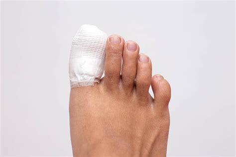 How Does a Podiatrist Treat An Ingrown Toenail?