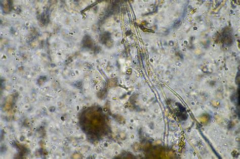 Fungal and Fungi Hyphae Under the Microscope in the Soil and Compost ...